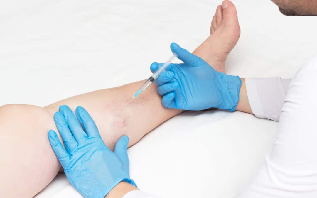 How Can I Find the Best Vein Center Near Me in CA?