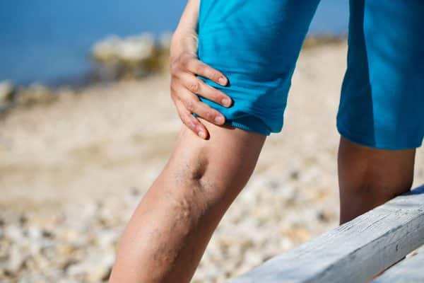 If you notice signs of vein disease then it is important to seek help from a Varicose Vein Treatment Center near me in San Diego. This article highlights some of the signs and symptoms that indicate underlying venous insufficiency.