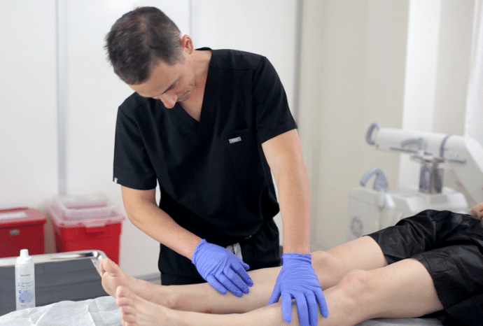 What Can I Expect from Varicose Vein Treatment Near San Diego?